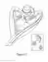 Fig. 04 - Method and apparatus for cochlear implant surgery
