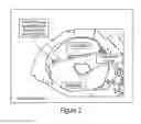 Fig. 05 - Method and apparatus for cochlear implant surgery