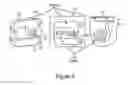 Fig. 07 - Method and apparatus for cochlear implant surgery