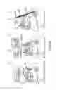 Fig. 09 - Method and apparatus for cochlear implant surgery