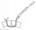 Fig. 01 - Soft tissue repair methods and apparatus
