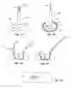 Fig. 02 - Soft tissue repair methods and apparatus