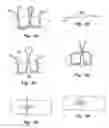 Fig. 05 - Soft tissue repair methods and apparatus