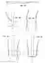 Fig. 06 - Soft tissue repair methods and apparatus