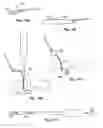 Fig. 08 - Soft tissue repair methods and apparatus