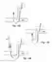 Fig. 10 - Soft tissue repair methods and apparatus