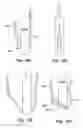 Fig. 11 - Soft tissue repair methods and apparatus