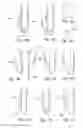Fig. 14 - Soft tissue repair methods and apparatus