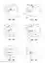 Fig. 05 - METHODS FOR REDUCTION OF GASTRIC LUMEN