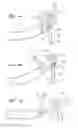 Fig. 07 - METHODS FOR REDUCTION OF GASTRIC LUMEN