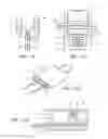 Fig. 10 - METHODS FOR REDUCTION OF GASTRIC LUMEN