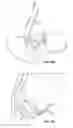 Fig. 23 - METHODS AND DEVICES FOR DELIVERING SUTURES IN TISSUE