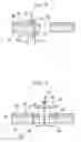 Fig. 07 - Perforation suturing method