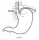 Fig. 05 - METHODS AND SYSTEMS FOR TREATING HIATAL HERNIAS