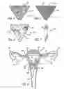 Fig. 03 - METHOD AND APPARATUS FOR CREATING INTRAUTERINE ADHESIONS