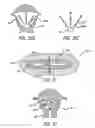 Fig. 09 - METHOD AND APPARATUS FOR CREATING INTRAUTERINE ADHESIONS