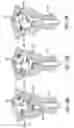 Fig. 10 - METHOD AND APPARATUS FOR CREATING INTRAUTERINE ADHESIONS