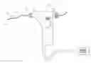 Fig. 01 - Plaque removal device with rotatable cutting element