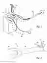 Fig. 02 - TUBULAR CUTTER DEVICE AND METHODS FOR CUTTING AND REMOVING STRIPS OF TISSUE FROM THE BODY OF A PATIENT