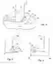 Fig. 04 - TUBULAR CUTTER DEVICE AND METHODS FOR CUTTING AND REMOVING STRIPS OF TISSUE FROM THE BODY OF A PATIENT