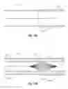 Fig. 13 - Implantable lumen filter with enhanced durability