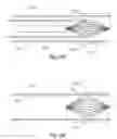 Fig. 15 - Implantable lumen filter with enhanced durability