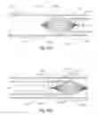 Fig. 17 - Implantable lumen filter with enhanced durability
