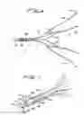 Fig. 05 - Vein filter
