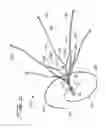 Fig. 08 - Vein filter