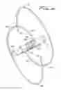 Fig. 13 - Vein filter