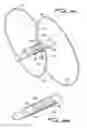Fig. 14 - Vein filter