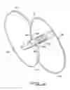Fig. 15 - Vein filter