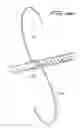 Fig. 17 - Vein filter