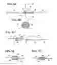 Fig. 04 - Distal protection devices having controllable wire motion