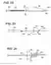 Fig. 13 - Distal protection devices having controllable wire motion
