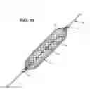 Fig. 22 - Distal protection devices having controllable wire motion