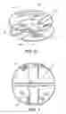Fig. 05 - Heart occlusion devices