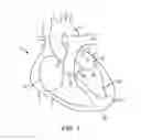 Fig. 02 - System for providing surgical access