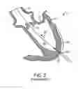 Fig. 03 - System for providing surgical access