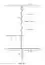 Fig. 11 - System for providing surgical access