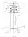 Fig. 20 - System for providing surgical access