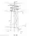 Fig. 22 - System for providing surgical access