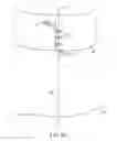 Fig. 26 - System for providing surgical access
