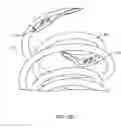 Fig. 30 - System for providing surgical access