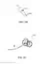 Fig. 32 - System for providing surgical access