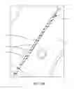 Fig. 41 - System for providing surgical access