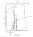 Fig. 45 - System for providing surgical access