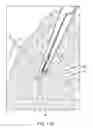 Fig. 48 - System for providing surgical access