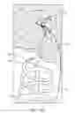 Fig. 49 - System for providing surgical access