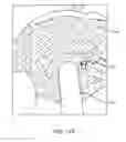 Fig. 51 - System for providing surgical access